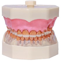 Manequim de Periodontia FG - Orais