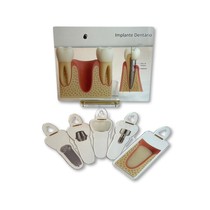 Quadro de Marcação Macromodelo Implante Dentário Camadas Dourado - Archneer
