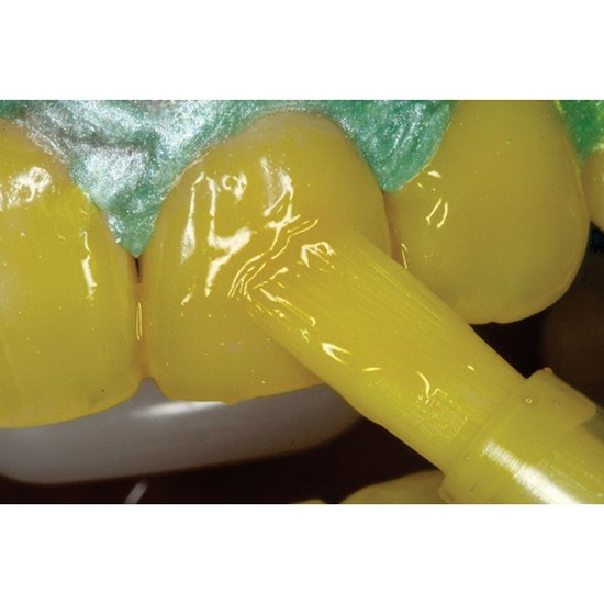 Kit Mix One Supreme 35 para 3 Pacientes - Villevie